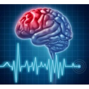 Accidentul vascular cerebral: cauze, simptome, preventie si tratare