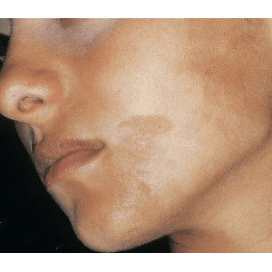 Reţete naturale de gomaj pentru faţă şi corp