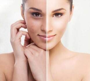 5 recomandari anti-stralucire pentru ingrijirea pielii mixte sau grase